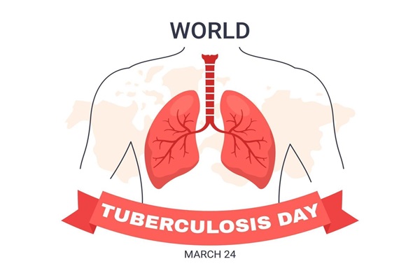 Minsa acerca servicios preventivos en la lucha contra la tuberculosis  