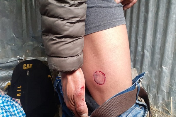 Mineros de Morococha son agredidos bombas lacrimógenas y perdigones